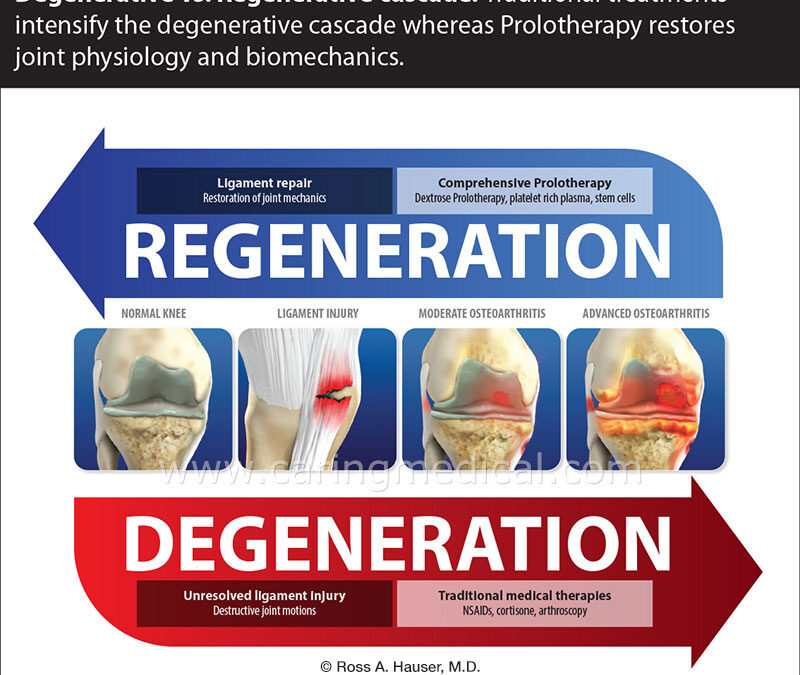 Prolotherapy Research and Treatment Guidelines